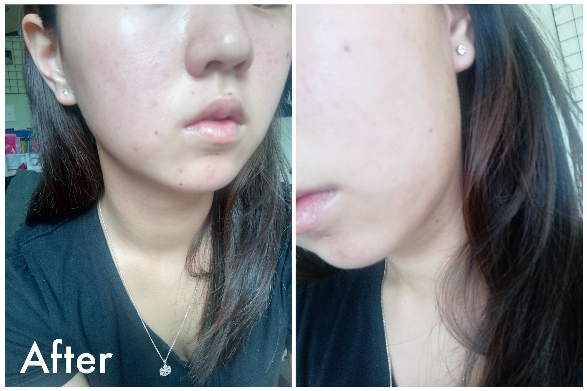 #YAYNAY Tester Team: Klairs Daily Skin Softening Water 💦