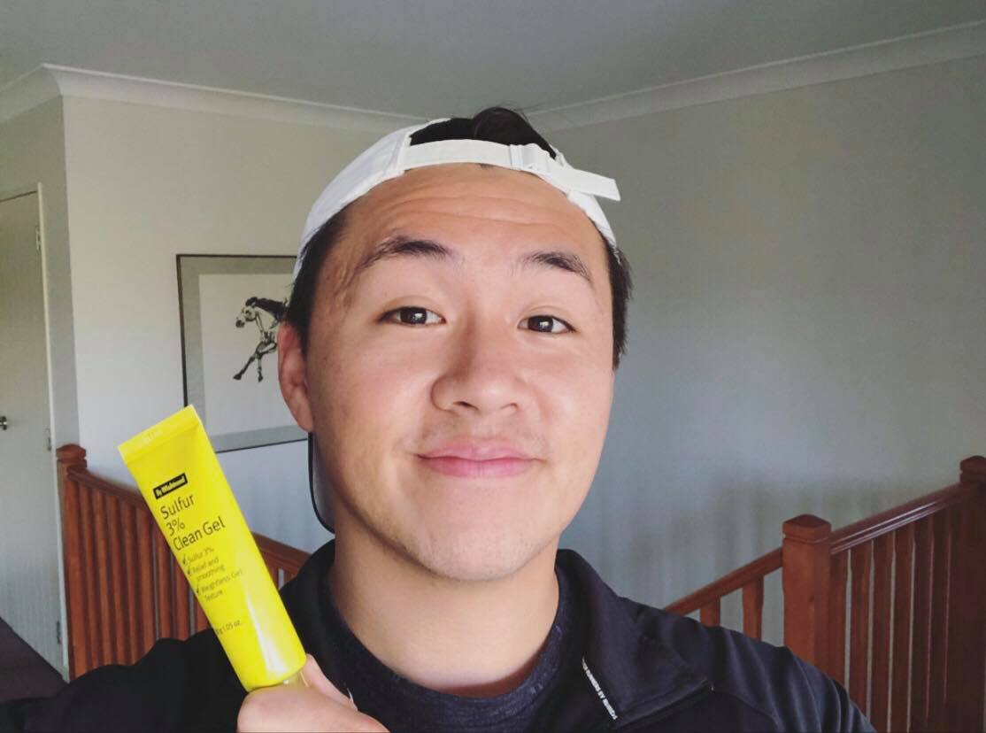 #YAYNAY TESTER TEAM: By Wishtrend Sulfur 3% Clean Gel 🌝 - Mid 20s