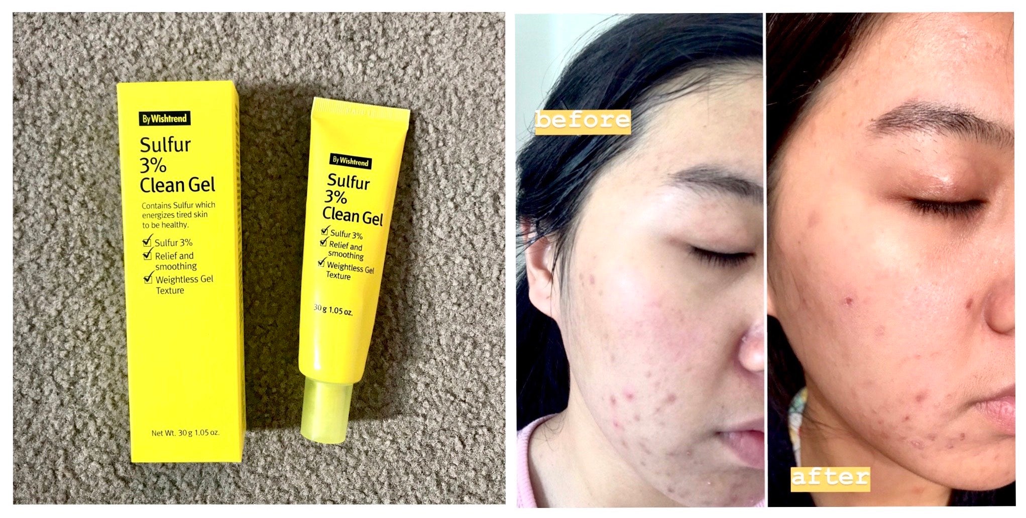 #YAYNAY TESTER TEAM: By Wishtrend Sulfur 3% Clean Gel 🌝 - Mid 20s