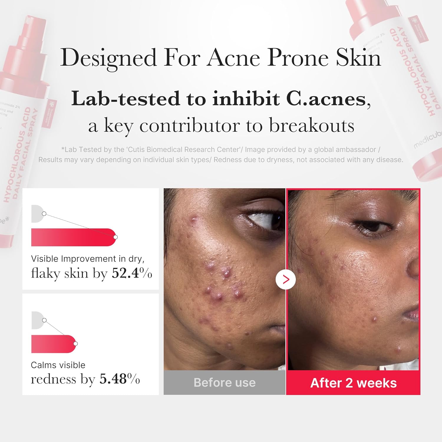 Hypochlorous Acid Daily Facial Spray