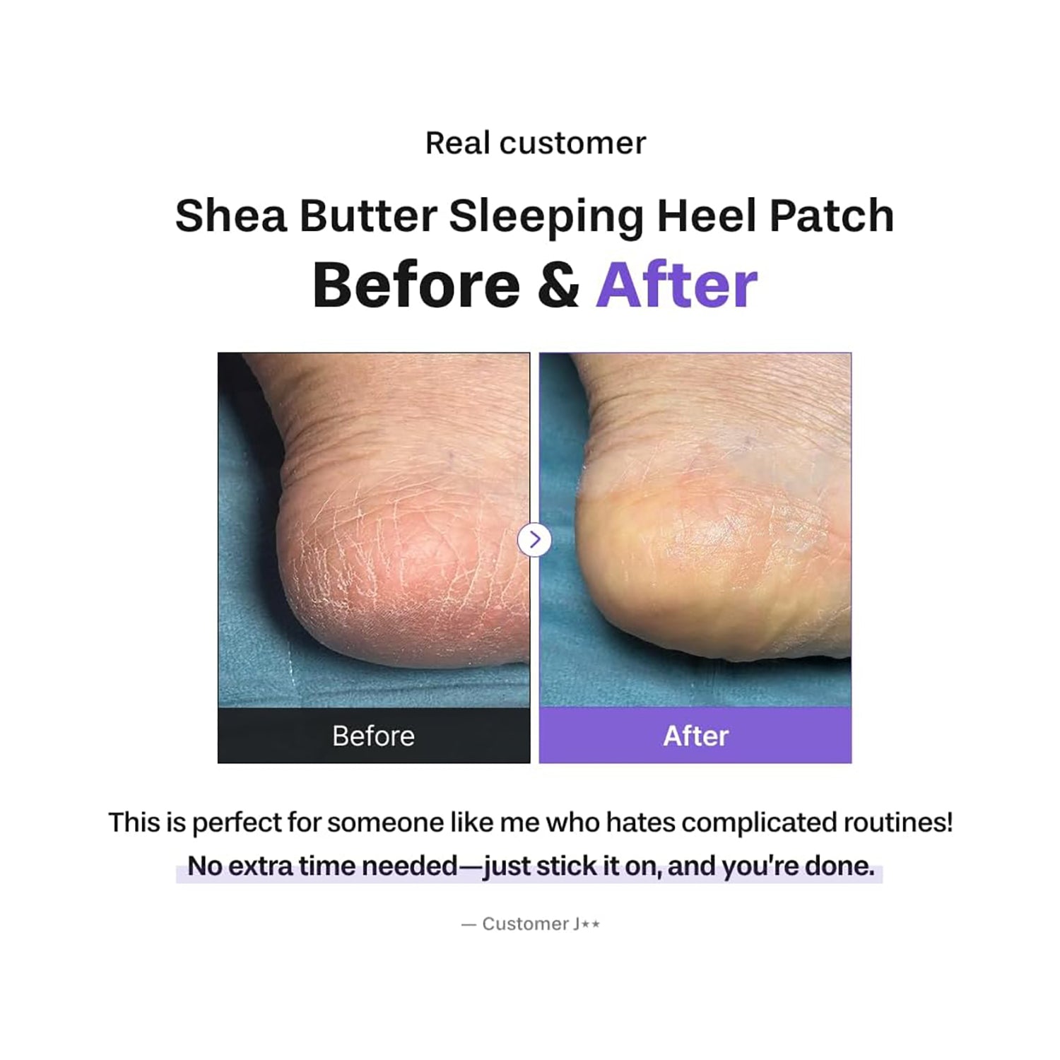 Shea Butter Sleeping Heel Patch [3 Pairs]