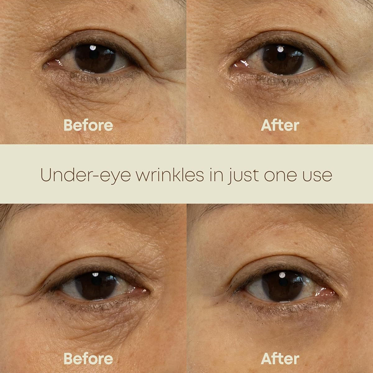 Ever-Youth Dual Effect Eye Cream