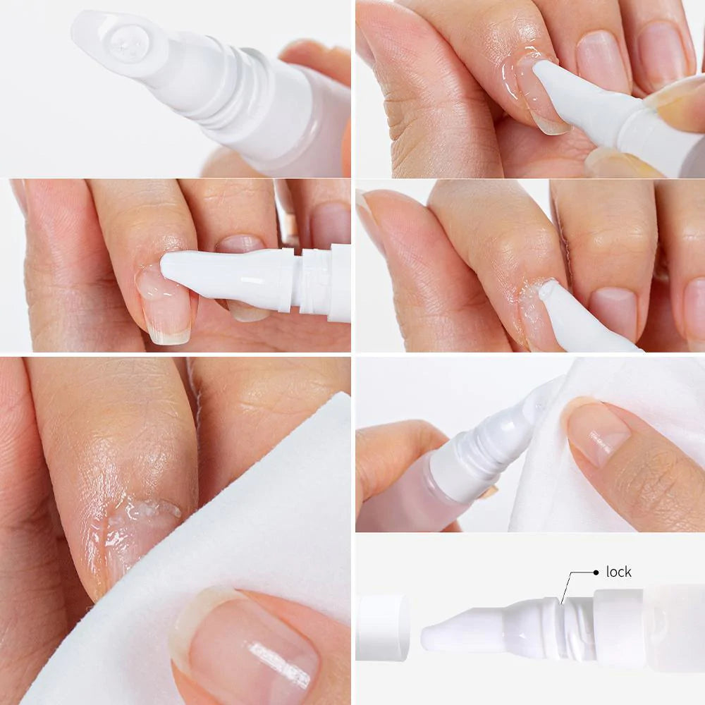 Pro Loose Skin Remover